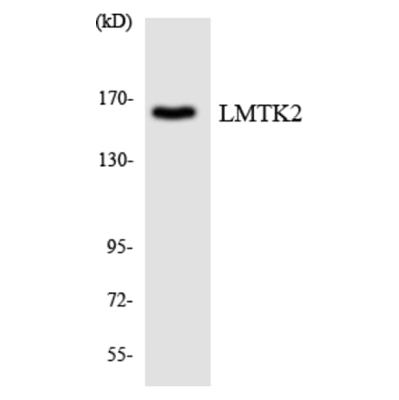 Western Blot - LMTK2 Cell Based ELISA Kit (CB6076) - Antibodies.com