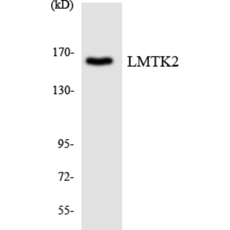 Western Blot - LMTK2 Cell Based ELISA Kit (CB6076) - Antibodies.com