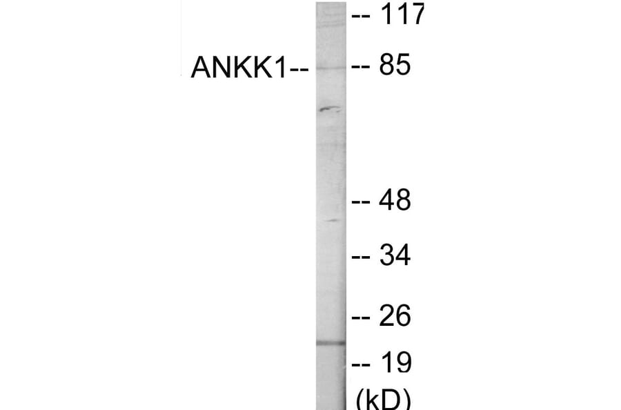 Western Blot - ANKK1 Cell Based ELISA Kit (CB6083) - Antibodies.com