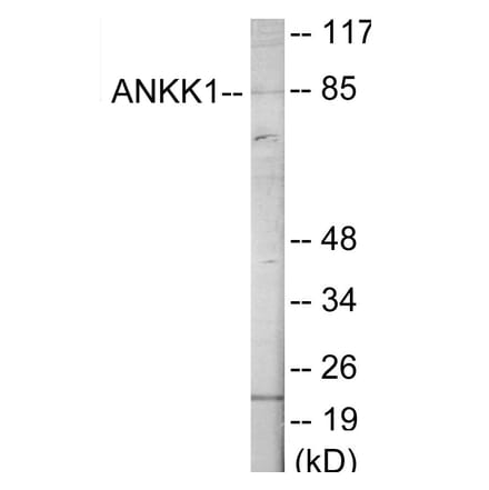 Western Blot - ANKK1 Cell Based ELISA Kit (CB6083) - Antibodies.com