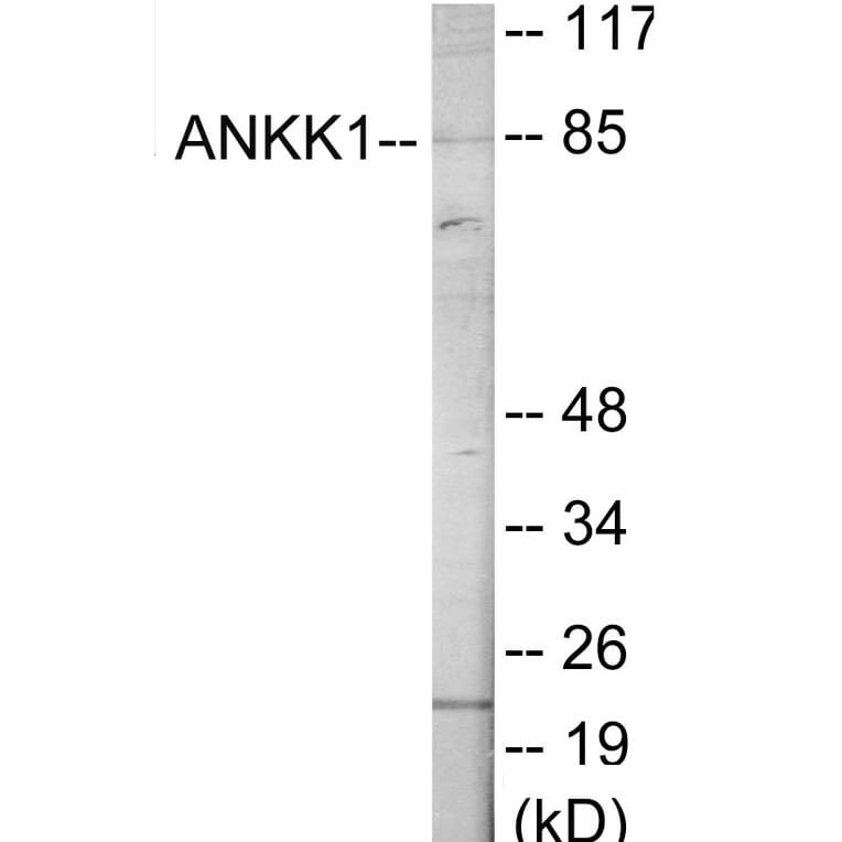 Western Blot - ANKK1 Cell Based ELISA Kit (CB6083) - Antibodies.com