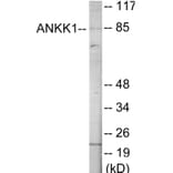 Western Blot - ANKK1 Cell Based ELISA Kit (CB6083) - Antibodies.com