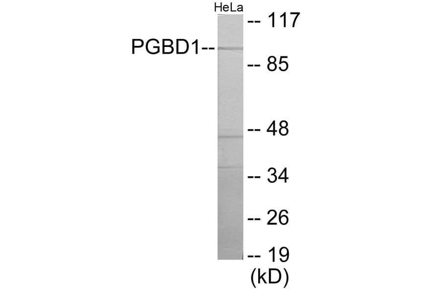 Western Blot - PGBD1 Cell Based ELISA Kit (CB6112) - Antibodies.com