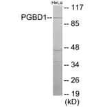 Western Blot - PGBD1 Cell Based ELISA Kit (CB6112) - Antibodies.com