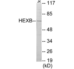 Western Blot - HEXB Cell Based ELISA Kit (CB5833) - Antibodies.com