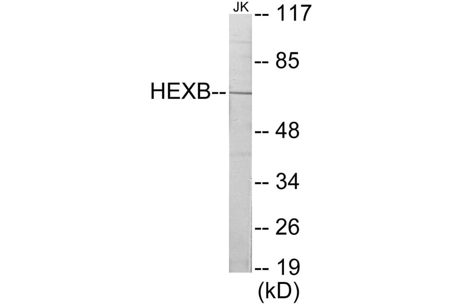 Western Blot - HEXB Cell Based ELISA Kit (CB5833) - Antibodies.com