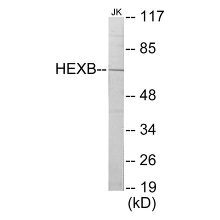 Western Blot - HEXB Cell Based ELISA Kit (CB5833) - Antibodies.com