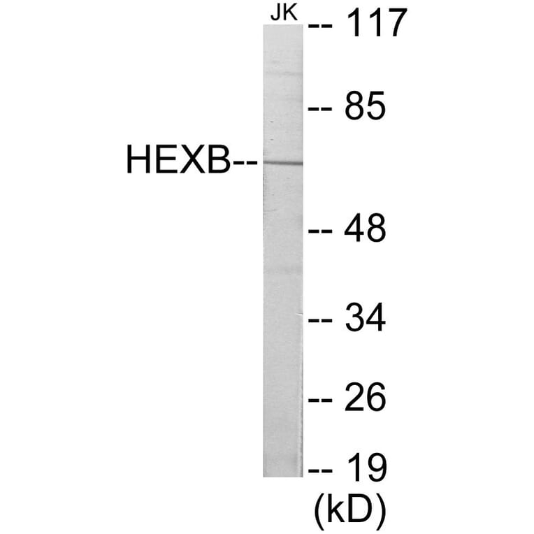 Western Blot - HEXB Cell Based ELISA Kit (CB5833) - Antibodies.com