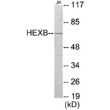 Western Blot - HEXB Cell Based ELISA Kit (CB5833) - Antibodies.com