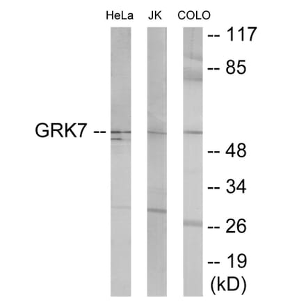 Western Blot - GRK7 Cell Based ELISA Kit (CB6093) - Antibodies.com