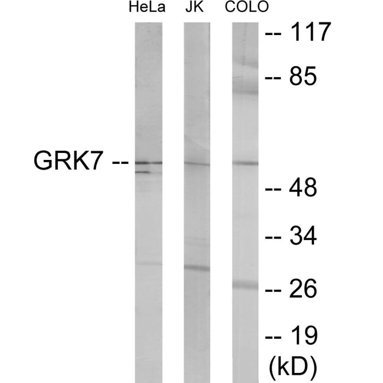 Western Blot - GRK7 Cell Based ELISA Kit (CB6093) - Antibodies.com