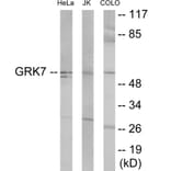 Western Blot - GRK7 Cell Based ELISA Kit (CB6093) - Antibodies.com