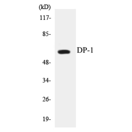 Western Blot - DP-1 Cell Based ELISA Kit (CB5210) - Antibodies.com