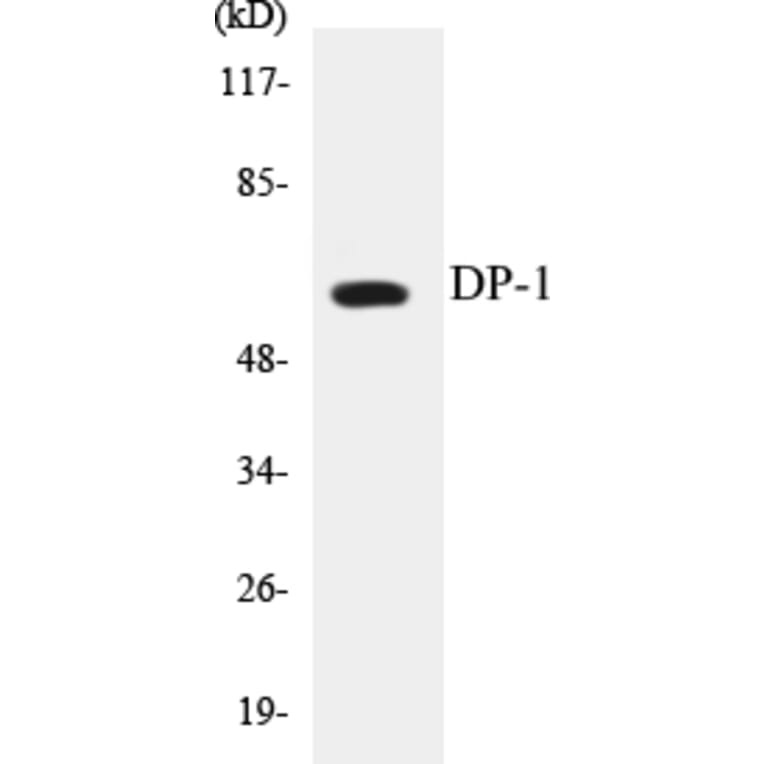Western Blot - DP-1 Cell Based ELISA Kit (CB5210) - Antibodies.com
