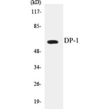 Western Blot - DP-1 Cell Based ELISA Kit (CB5210) - Antibodies.com