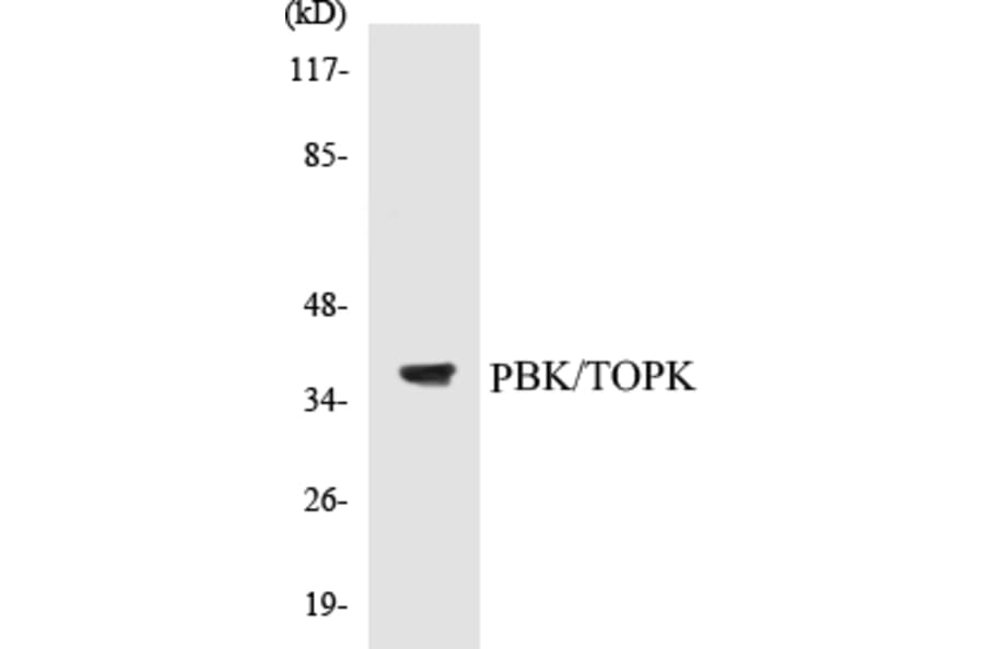 Western Blot - TOPK Cell Based ELISA Kit (CB5539) - Antibodies.com