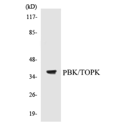 Western Blot - TOPK Cell Based ELISA Kit (CB5539) - Antibodies.com