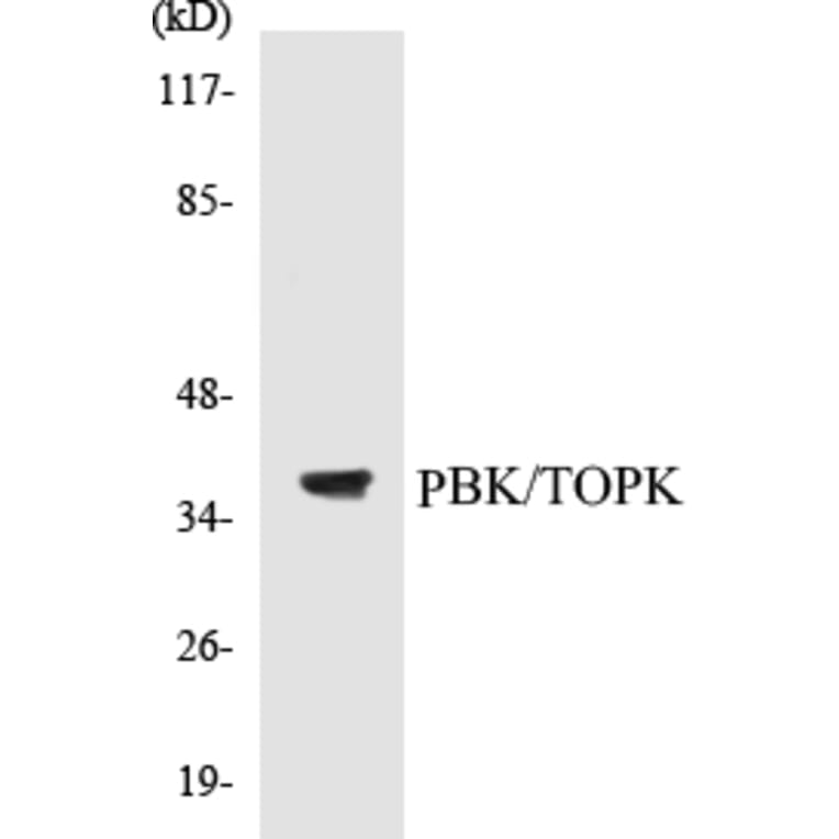 Western Blot - TOPK Cell Based ELISA Kit (CB5539) - Antibodies.com