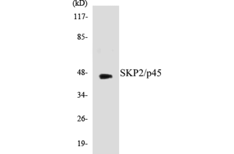 Western Blot - SKP2 Cell Based ELISA Kit (CB5635) - Antibodies.com