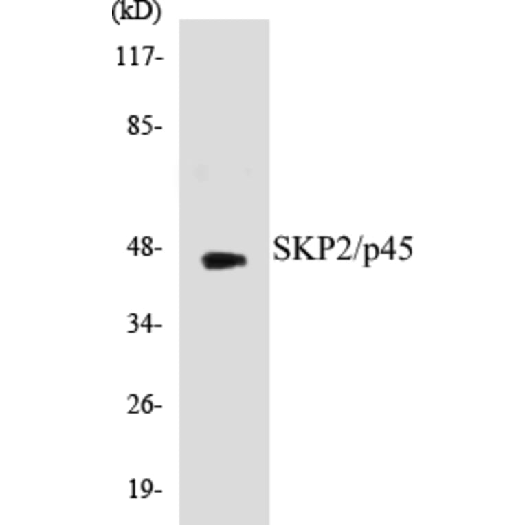 Western Blot - SKP2 Cell Based ELISA Kit (CB5635) - Antibodies.com