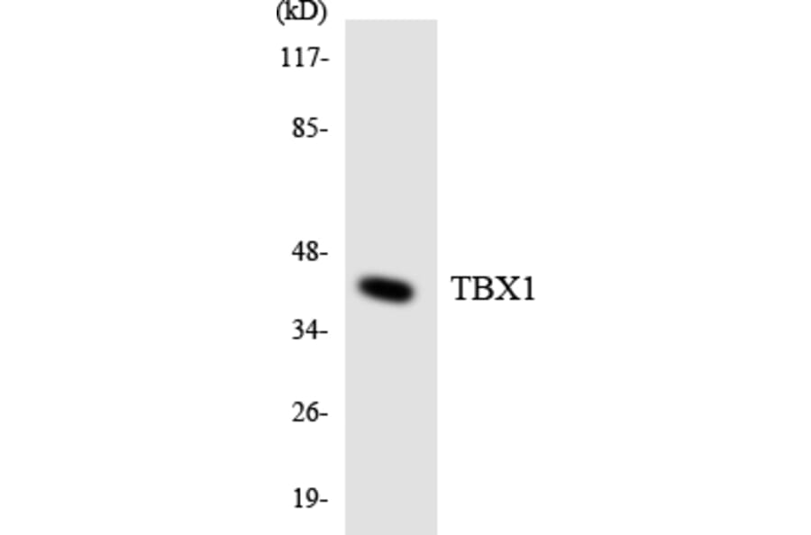 Western Blot - TBX1 Cell Based ELISA Kit (CB5782) - Antibodies.com