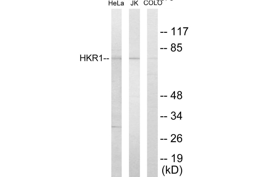 Western Blot - HKR1 Cell Based ELISA Kit (CB5836) - Antibodies.com