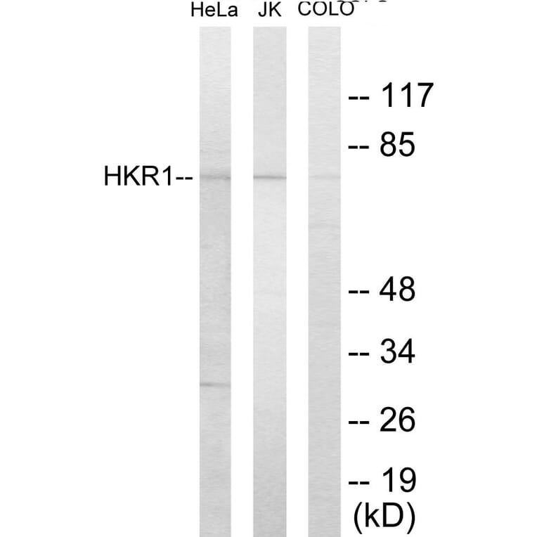 Western Blot - HKR1 Cell Based ELISA Kit (CB5836) - Antibodies.com