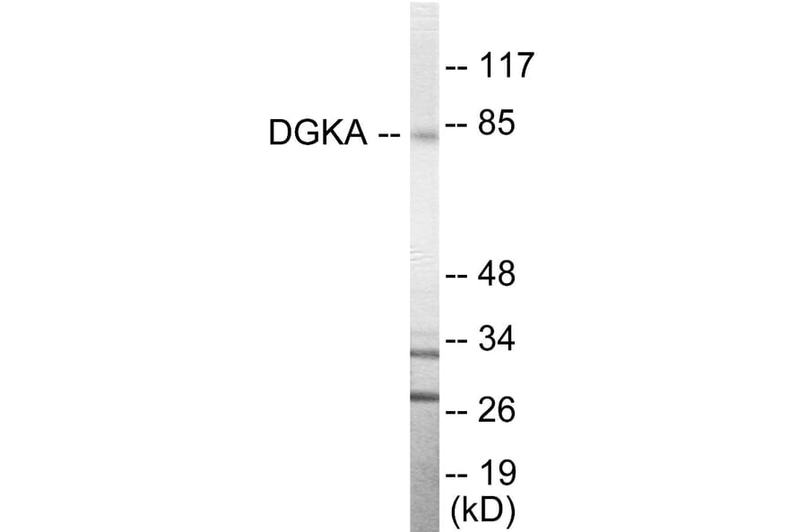 Western Blot - DGKA Cell Based ELISA Kit (CB5861) - Antibodies.com