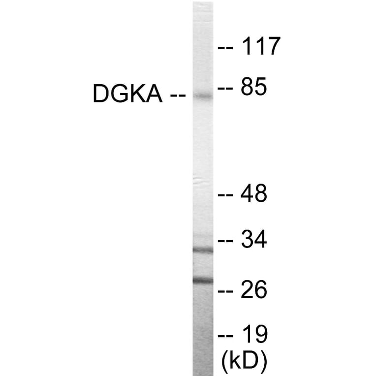 Western Blot - DGKA Cell Based ELISA Kit (CB5861) - Antibodies.com