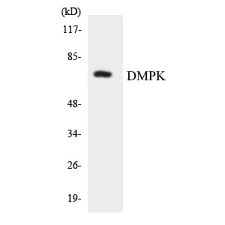 Western Blot - DMPK Cell Based ELISA Kit (CB5968) - Antibodies.com