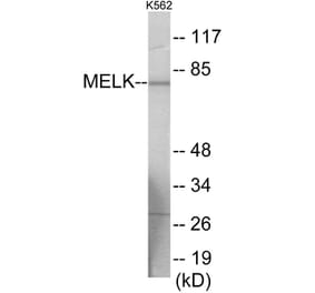 Western Blot - MELK Cell Based ELISA Kit (CB6007) - Antibodies.com