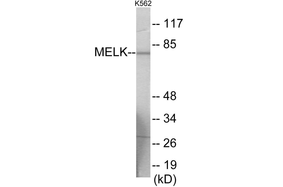 Western Blot - MELK Cell Based ELISA Kit (CB6007) - Antibodies.com