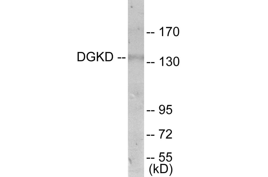 Western Blot - DGKD Cell Based ELISA Kit (CB6041) - Antibodies.com