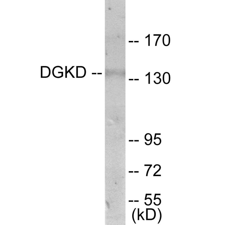 Western Blot - DGKD Cell Based ELISA Kit (CB6041) - Antibodies.com