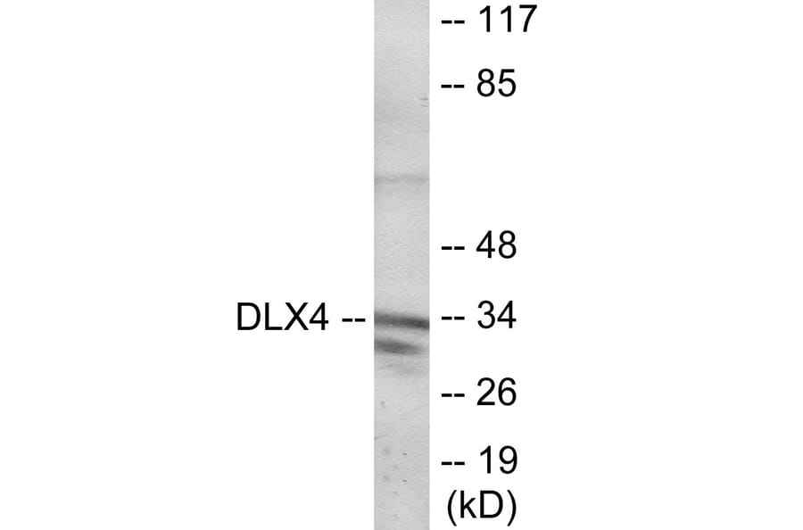 Western Blot - DLX4 Cell Based ELISA Kit (CB6104) - Antibodies.com