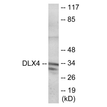 Western Blot - DLX4 Cell Based ELISA Kit (CB6104) - Antibodies.com