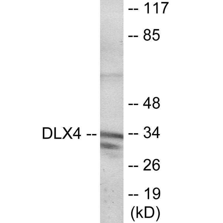 Western Blot - DLX4 Cell Based ELISA Kit (CB6104) - Antibodies.com