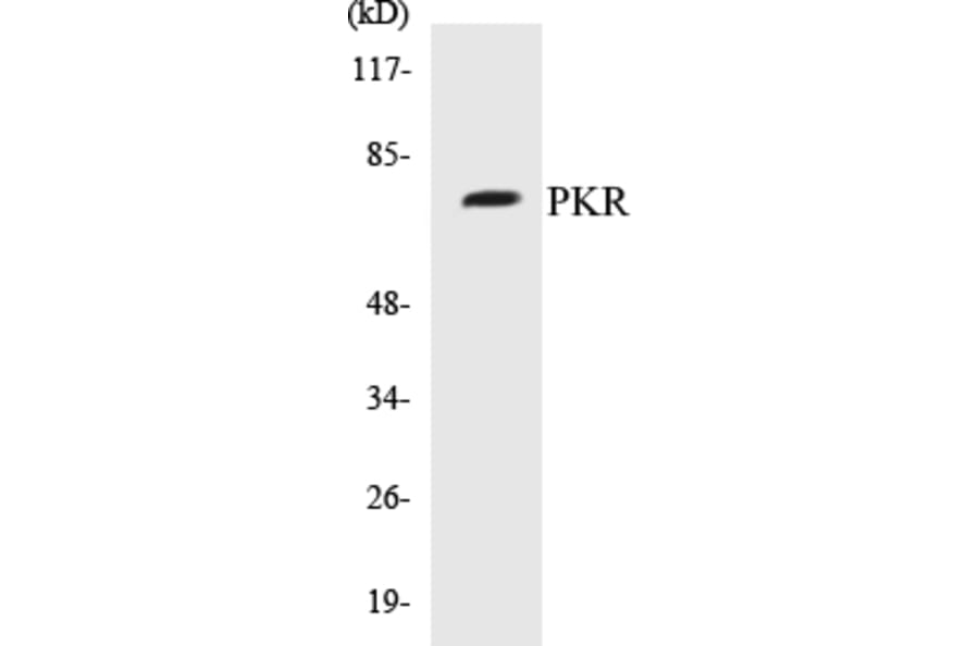 Western Blot - PKR Cell Based ELISA Kit (CB5572) - Antibodies.com
