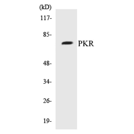 Western Blot - PKR Cell Based ELISA Kit (CB5572) - Antibodies.com