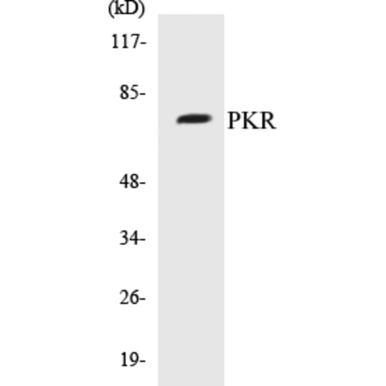 Western Blot - PKR Cell Based ELISA Kit (CB5572) - Antibodies.com