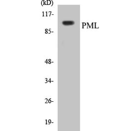 Western Blot - PML Cell Based ELISA Kit (CB5578) - Antibodies.com