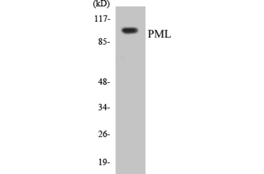 Western Blot - PML Cell Based ELISA Kit (CB5578) - Antibodies.com