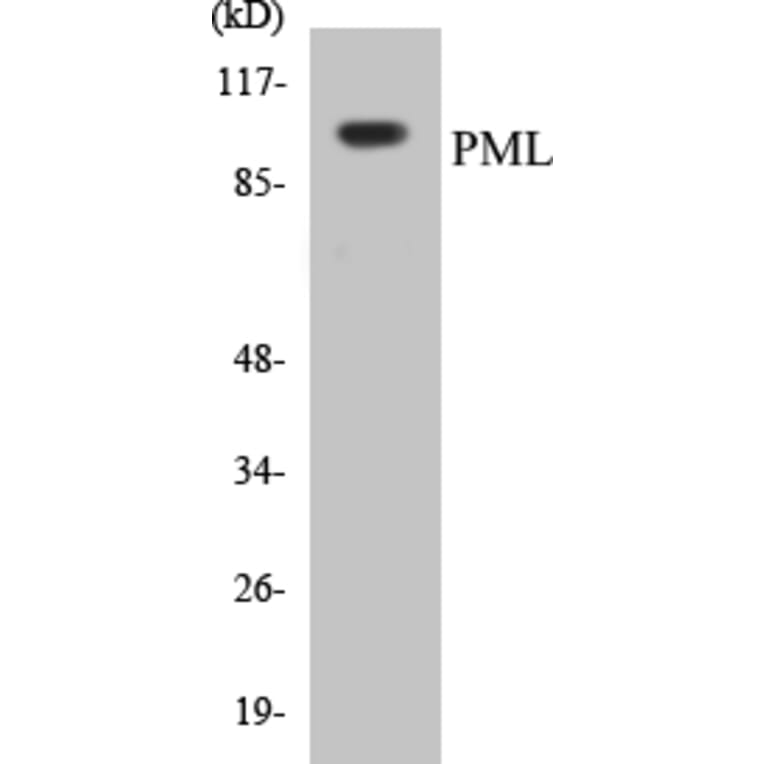 Western Blot - PML Cell Based ELISA Kit (CB5578) - Antibodies.com