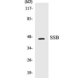 Western Blot - SSB Cell Based ELISA Kit (CB5652) - Antibodies.com