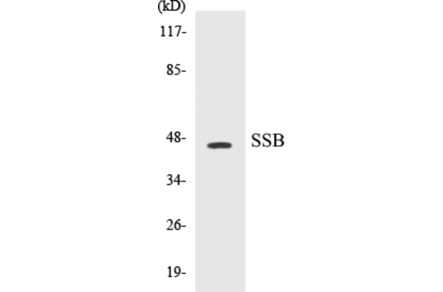 Western Blot - SSB Cell Based ELISA Kit (CB5652) - Antibodies.com