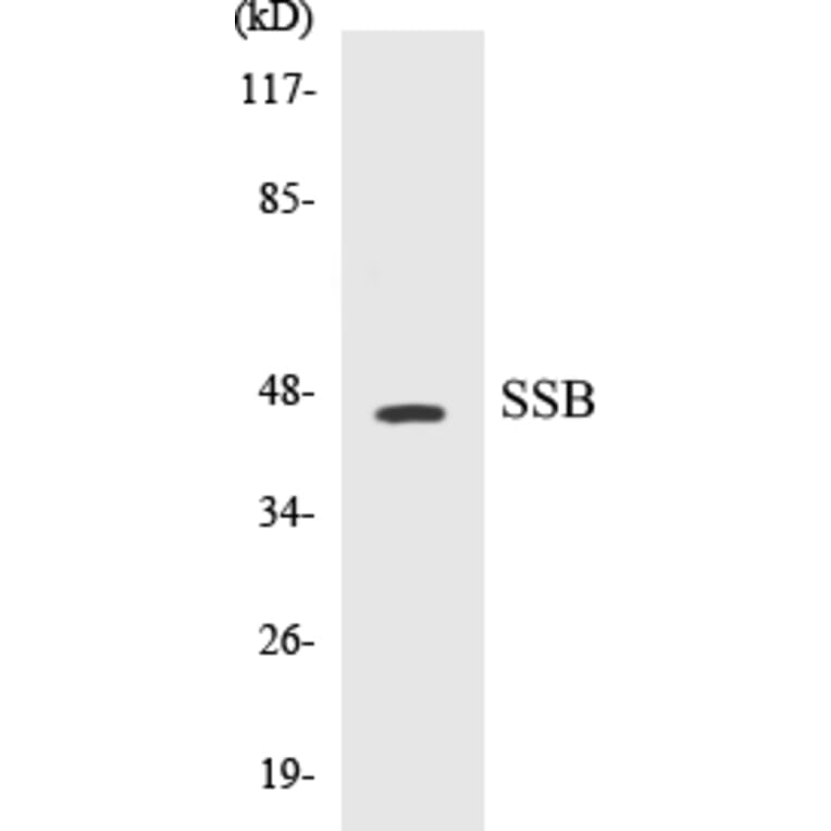 Western Blot - SSB Cell Based ELISA Kit (CB5652) - Antibodies.com