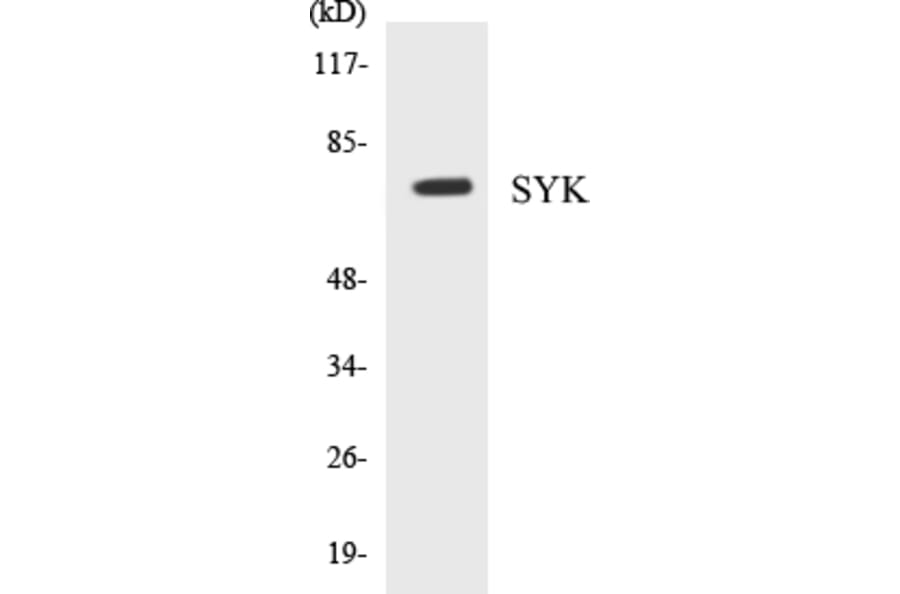 Western Blot - SYK Cell Based ELISA Kit (CB5667) - Antibodies.com