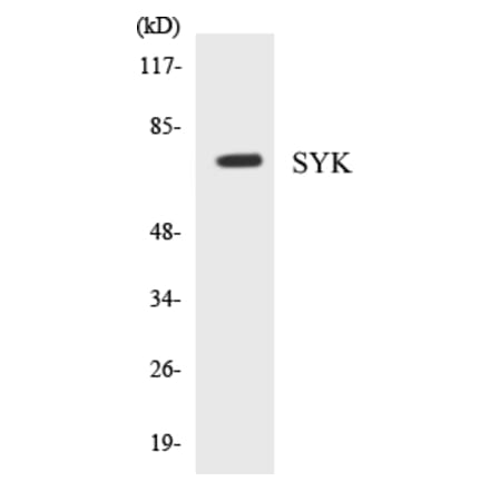 Western Blot - SYK Cell Based ELISA Kit (CB5667) - Antibodies.com