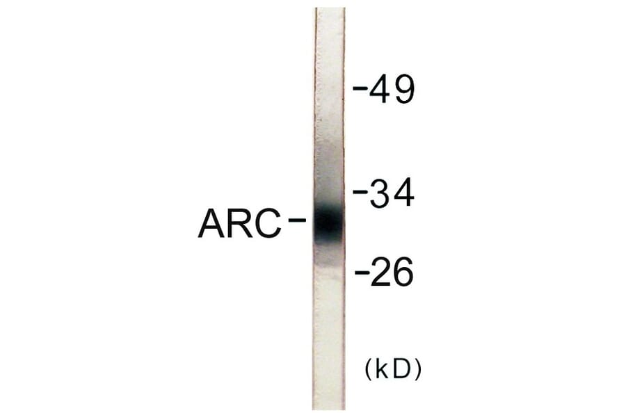 Western Blot - ARC Cell Based ELISA Kit (CB5741) - Antibodies.com