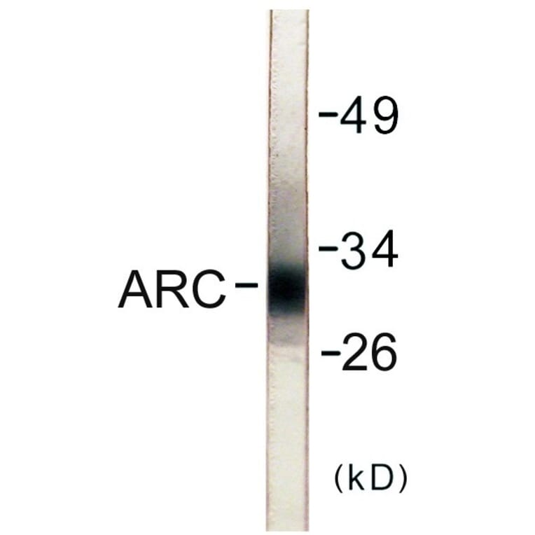 Western Blot - ARC Cell Based ELISA Kit (CB5741) - Antibodies.com